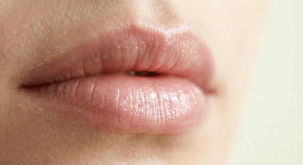 Labios hidratados tras tratamiento de aumento con ácido hialurónico