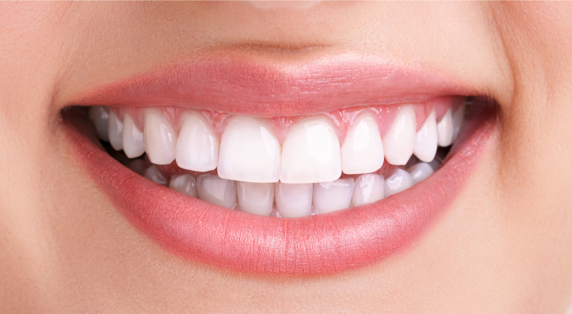 img tratamiento dental blanqueamiento clinica pereira sevilla